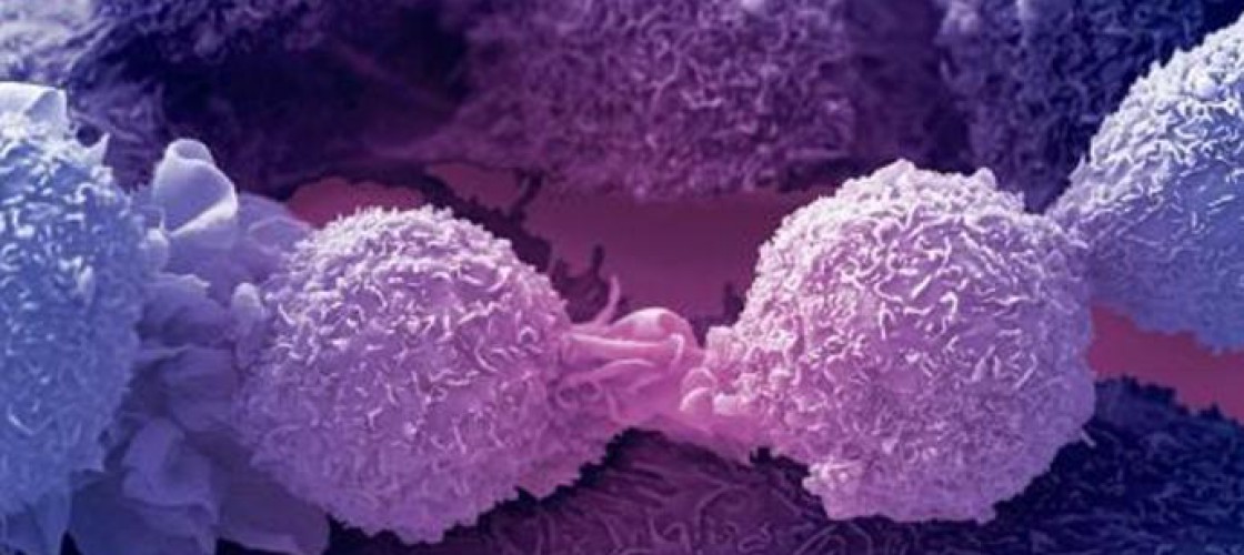 ​Naukowcy z UAM prowadzą badania, które mają pomóc w walce z nowotworem